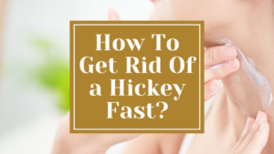 How To Get Rid Of a Hickey Fast?